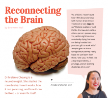 Reconnecting the brain cover.